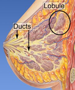Read more about the article Ductal carcinoma in situ (DCIS)